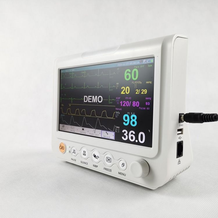 Langlebiger 7-Zoll-Vitalzeichenmonitor Multiparameter-Monitor Veterinär-Vitalzeichenmonitor