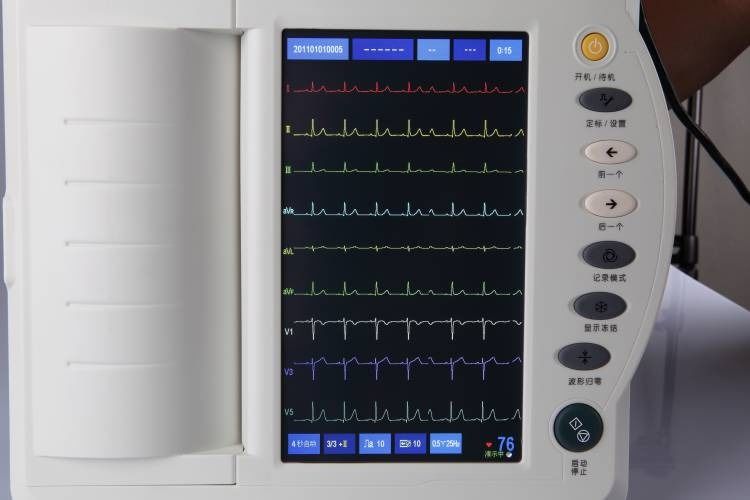 Humaner EKG-Gerät Herzuntersuchung Kardiologie 12-Kanal-EKG-Gerät EKG-Elektrokardiogramm-Gerät EKG