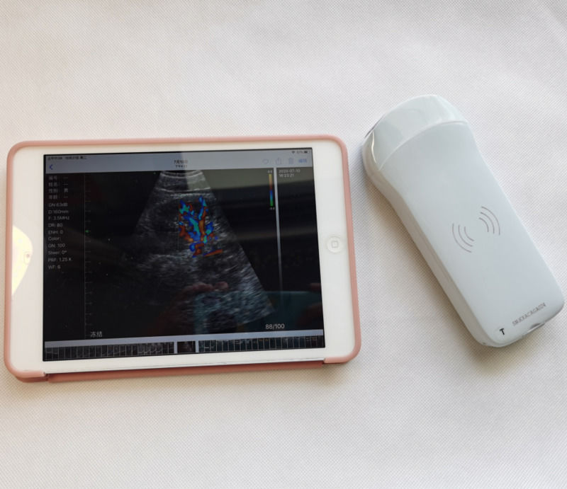 Usg New Look 3d Image GYN Image Laptop Ob Gyn Fetal Ultraschallmaschine Farb-Doppler mit hoher Qualität