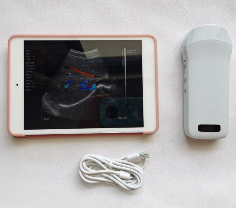 Usg New Look 3d Image GYN Image Laptop Ob Gyn Fetal Ultraschallmaschine Farb-Doppler mit hoher Qualität