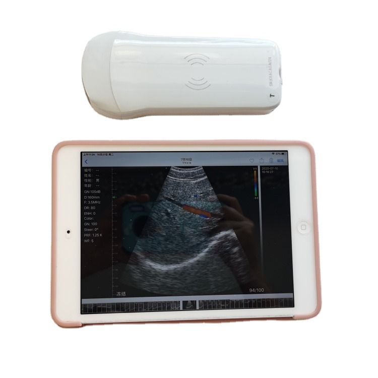 GYN Hochwertiges tragbares Veterinärgerät, schnelle Lieferung, 3D-Diagnose, medizinisches Ultraschallgerät für Pferde, für Kühe