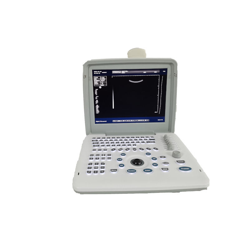 Metal See Laptop B W Portable Schwangerschaft Doppler-Sonde Scanner Radio Fetal Ultraschall-Maschine für Baby