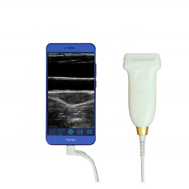 GYN Ultraschallsonde konvexe WiFi USB drahtlose Ultraschallsonden für Android