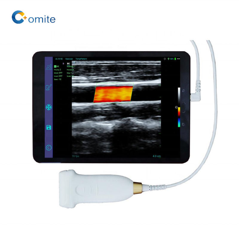 GYN Ultraschallsonde konvexe WiFi USB drahtlose Ultraschallsonden für Android