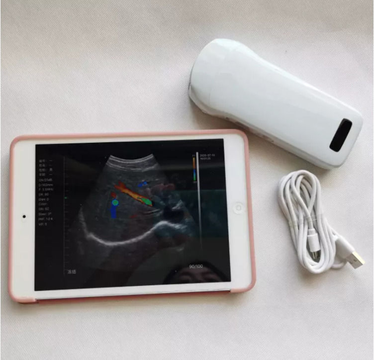 GYN Ultraschall-Instrumente drahtlose tragbare klinische Sonde Analyseinstrumente mobile Ultraschallmaschine