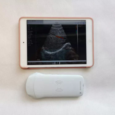 GYN Ultraschall-Instrumente drahtlose tragbare klinische Sonde Analyseinstrumente mobile Ultraschallmaschine