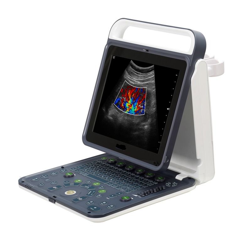 Krankenhaus Außen 2020 Neue tragbare digitale 15-Zoll-Farb-Doppler-Ultraschallmaschine