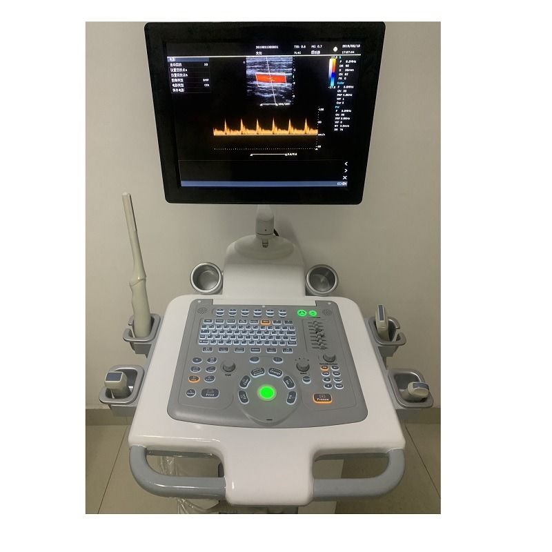 Krankenhaus Außerhalb Wagen 15 Zoll Ultraschallgerät Ultraschall Digitaler Farbdoppler Ultraschallgeräte Medizinisch