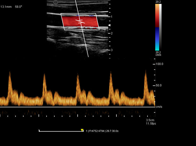 China Cart Digital Farb-Doppler Ultraschall Medizinische Ultraschallmaschine Ultraschall Krankenhaus Außen