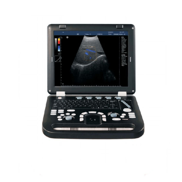 100% garantierter tragbarer Farbdoppler-Ultraschall-Echokardiographie-Echo-Ultraschallgerät