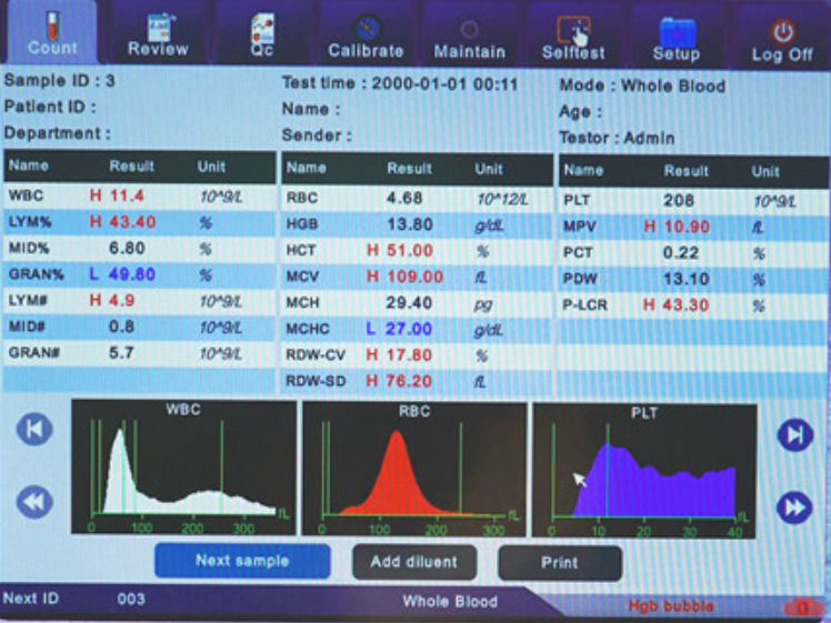 Klinische analytische vollautomatische Hämatologie-Instrumente Blutzell-Analysator Comite Plus vollautomatischer Hämatologie-Analysator CMT-800